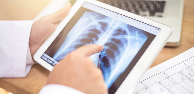 中國(guó)專(zhuān)家分享新冠肺炎患者急性呼吸窘迫并進(jìn)展至死亡的危險(xiǎn)因素